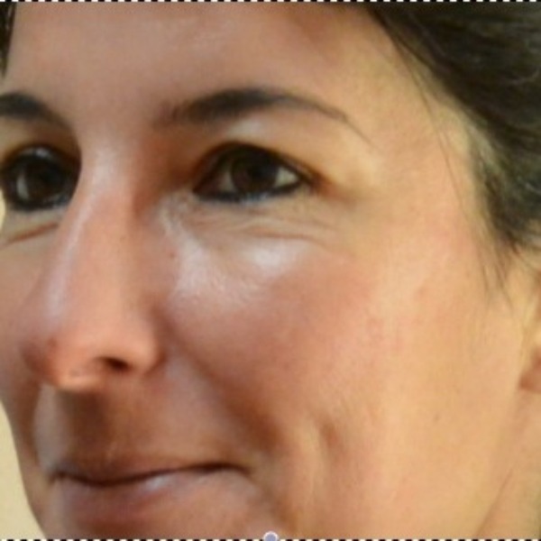 Caroline